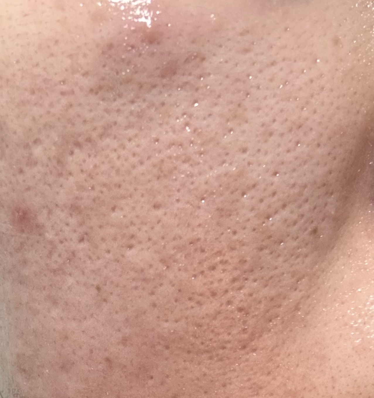 アルティミューン™ パワライジング セラム/SHISEIDO/美容液を使ったクチコミ（1枚目）