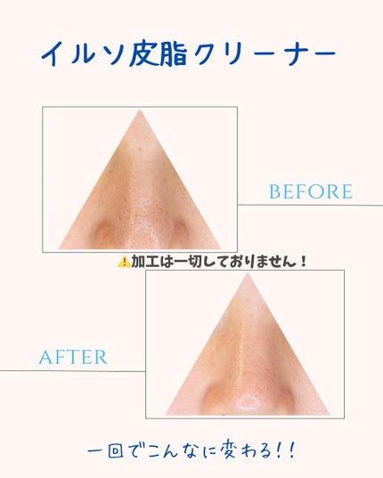 ディープクリーンマスター/ilso/その他スキンケアグッズを使ったクチコミ(6枚目)