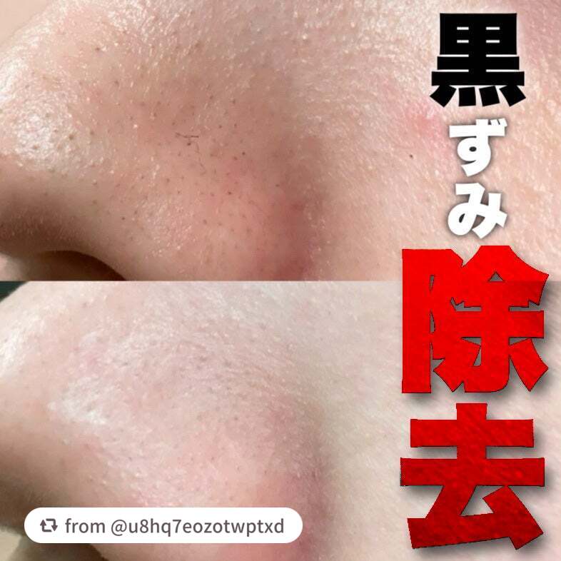 素敵な投稿をありがとうございます🫧
＝＝＝＝＝＝＝＝＝＝＝＝＝＝＝＝＝

【u8hq7eozotwptxdさんから引用】

“ふとした時に気になる毛穴の黒ずみ、綺麗にしたいならこれ試して！

&honey
サボン クレンジングオイル ブル