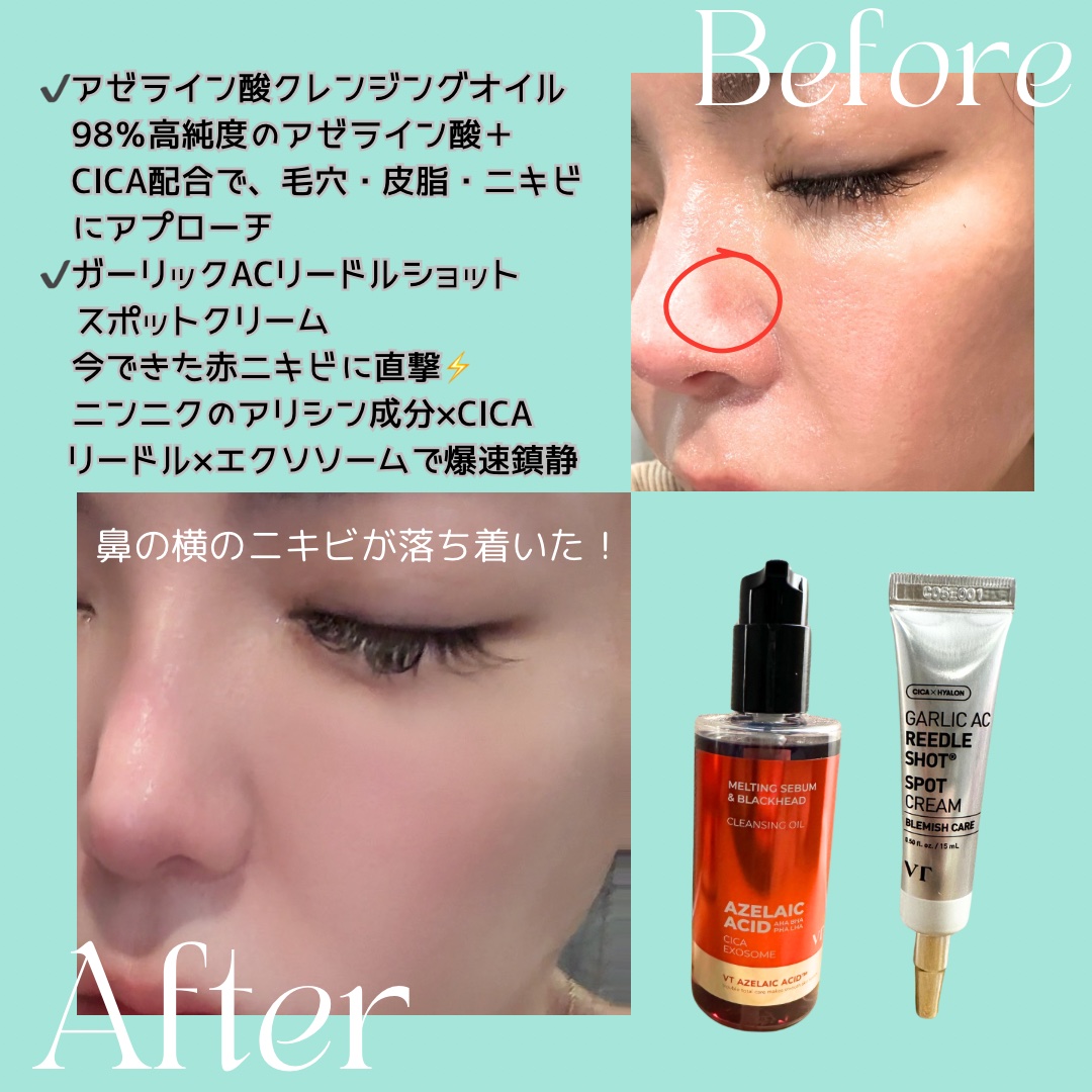 AZケア クレンジングオイル/VT/オイルクレンジングを使ったクチコミ（2枚目）