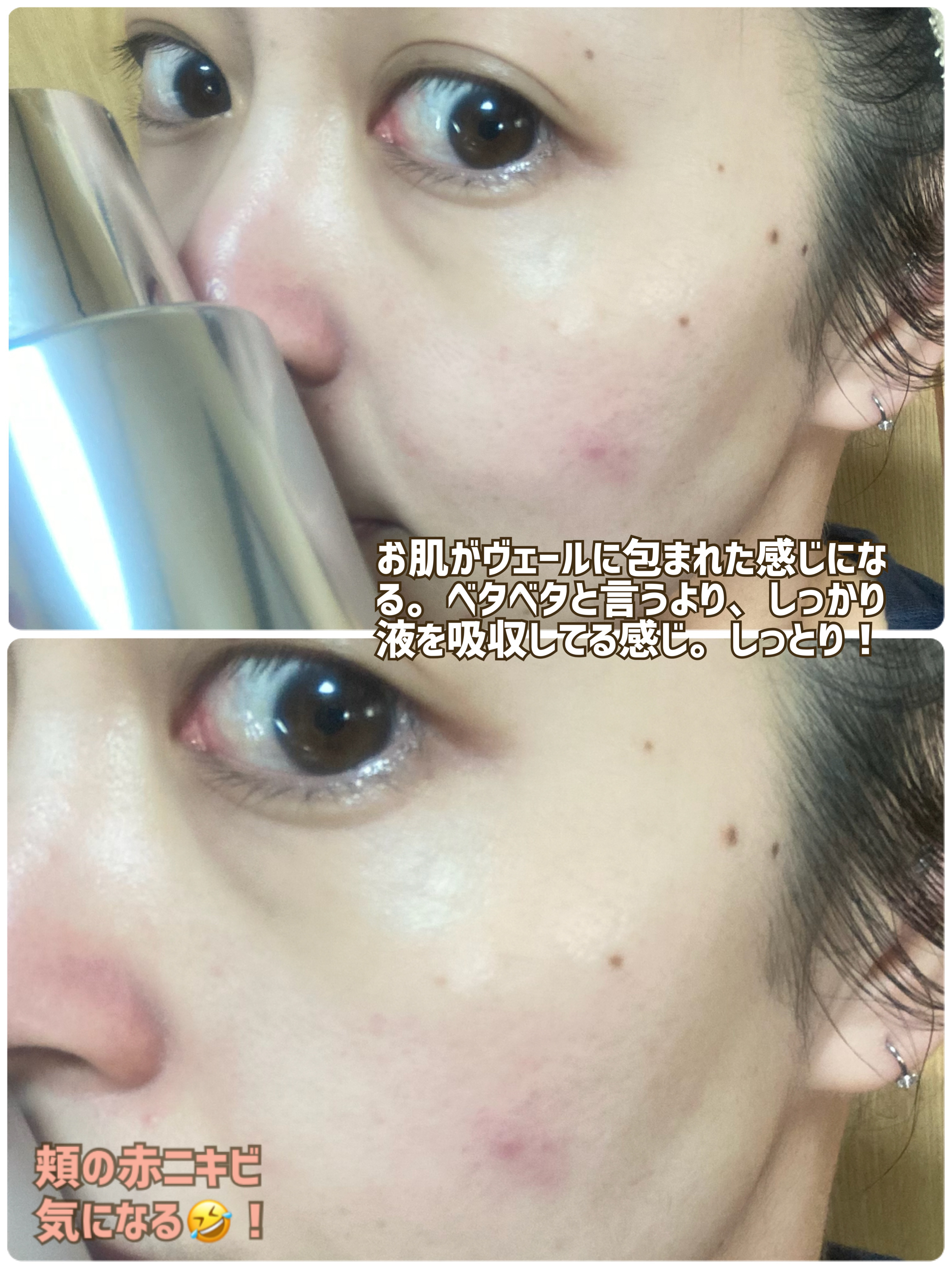 エクソリペア 美容原液ローション クリア/Bアンプル/化粧水を使ったクチコミ（3枚目）