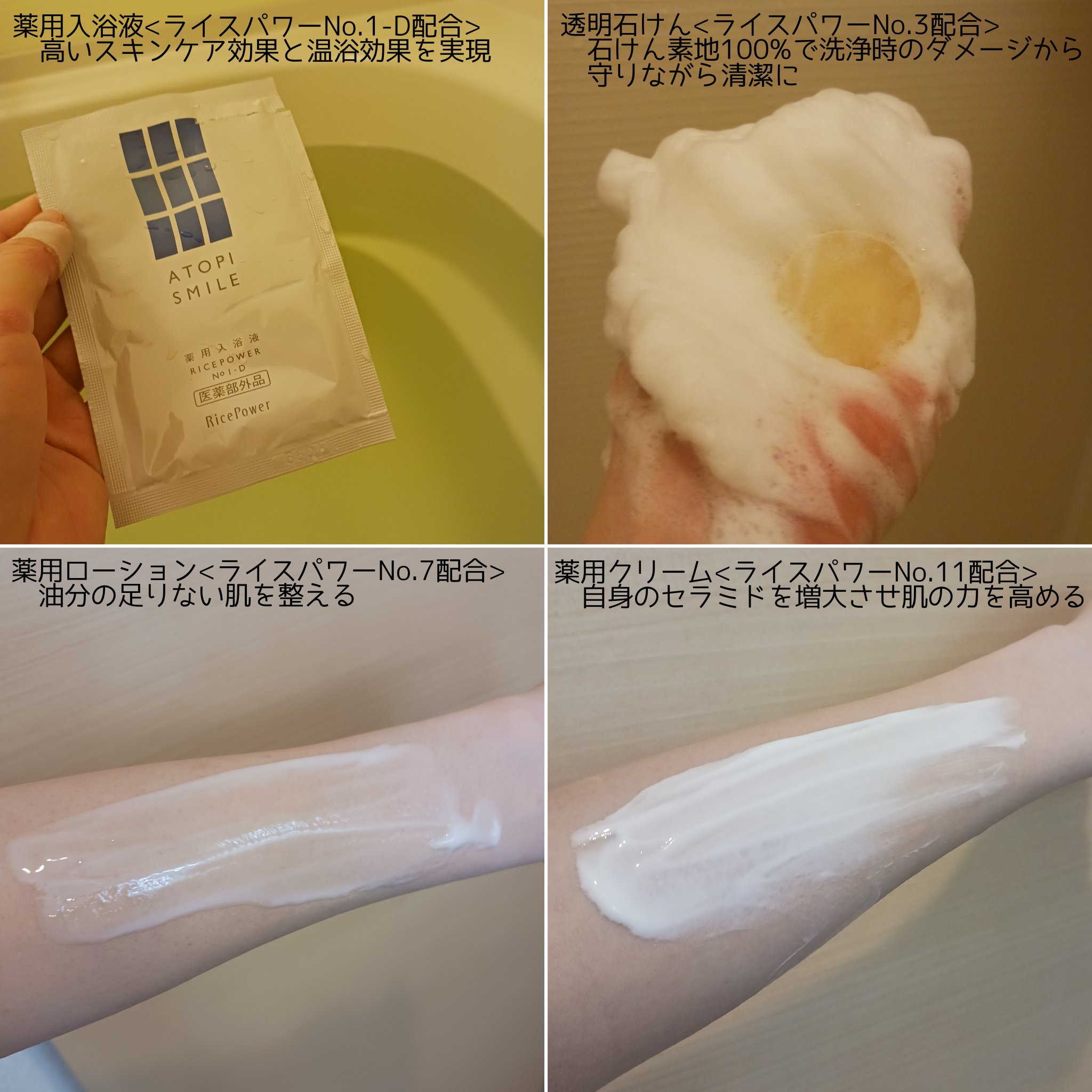 薬用ボディローション/アトピスマイル/ボディローションを使ったクチコミ（2枚目）