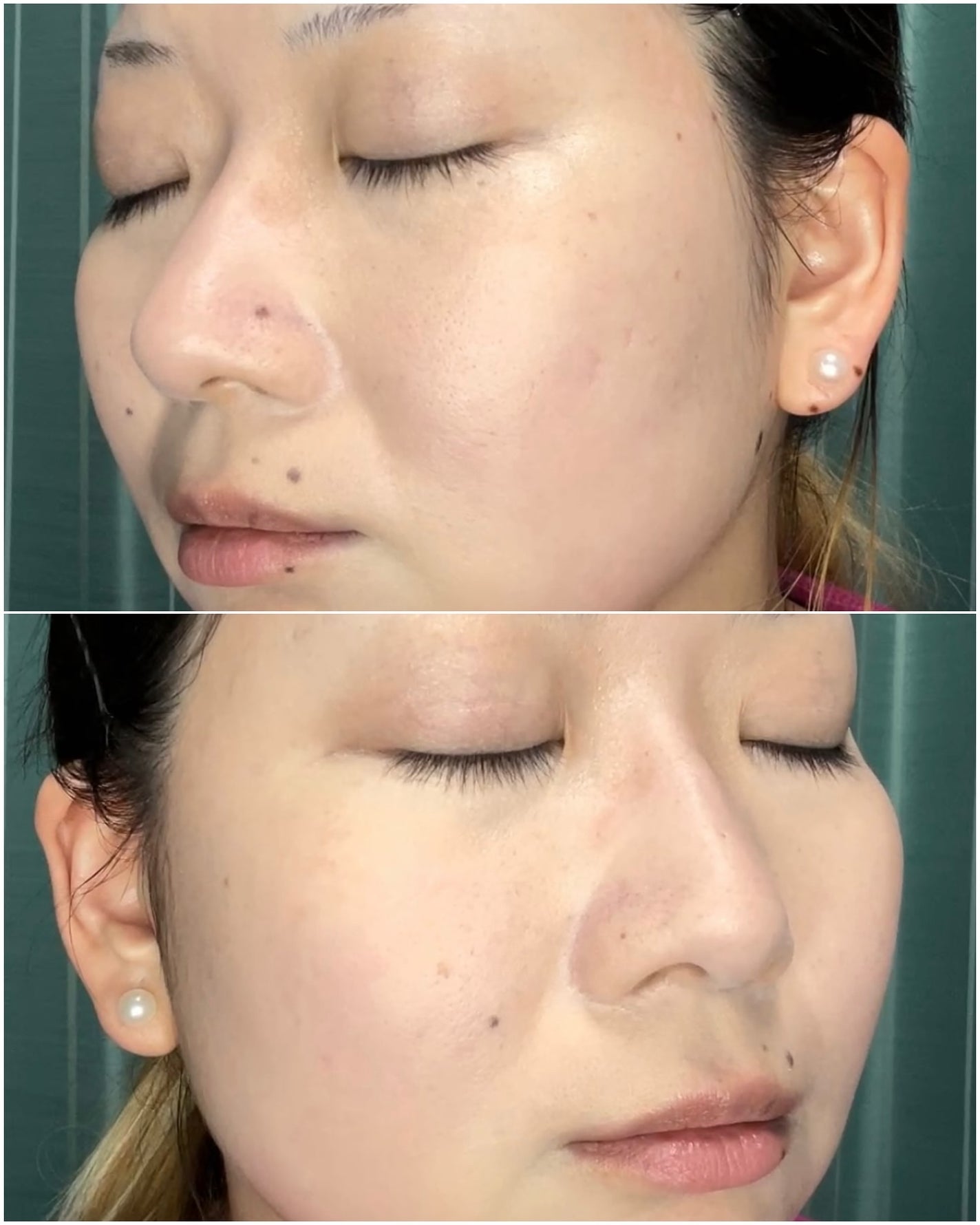 ミネラルファンデーション/D-RAY/パウダーファンデーションを使ったクチコミ(6枚目)