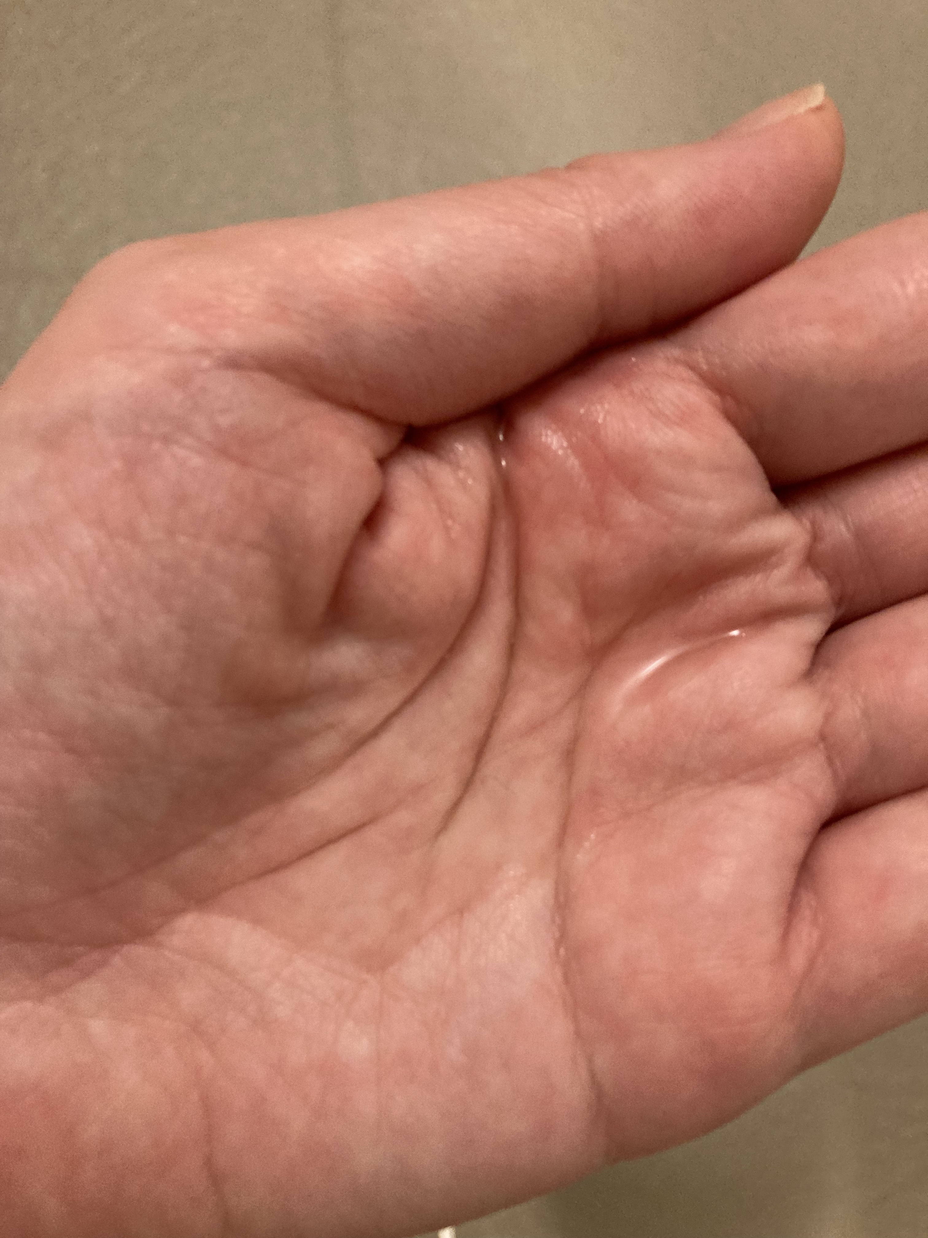 エクソリペア 美容原液ローション クリア/Bアンプル/化粧水を使ったクチコミ（2枚目）