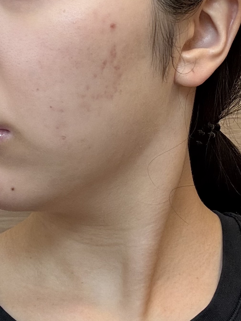 浸透湿潤セラミド１０％★ナノエマルジョン/TOUT VERT/乳液を使ったクチコミ（2枚目）