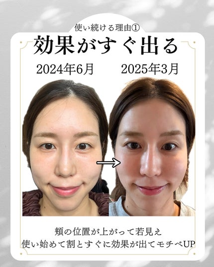 フェイスプレイヤー2/COREFIT/美顔器・マッサージを使ったクチコミ(3枚目)