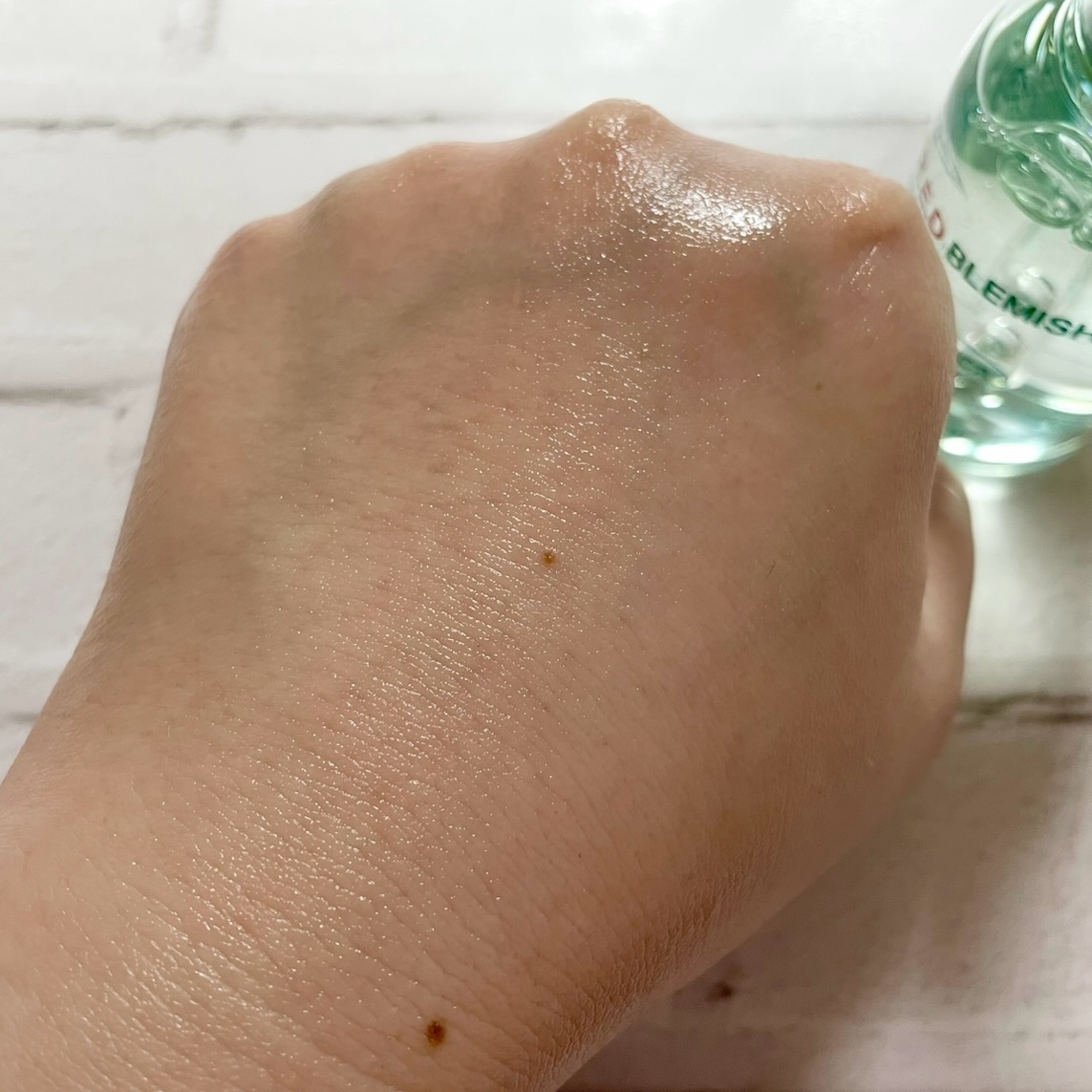 レッドブレミッシュ クリアヒアルシカスージングセラム/Dr.G/美容液を使ったクチコミ（3枚目）