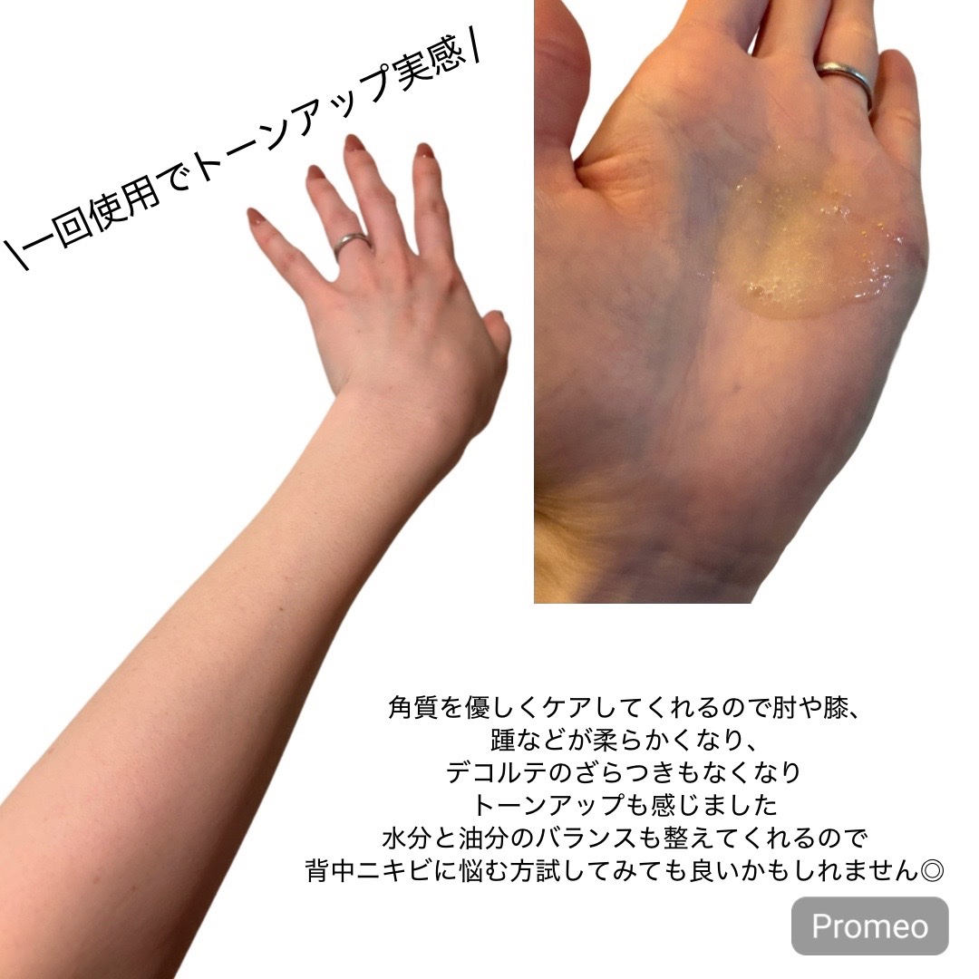 B3 アクネ クリア ボディウォッシュ/b.clinicx/ボディソープを使ったクチコミ（3枚目）