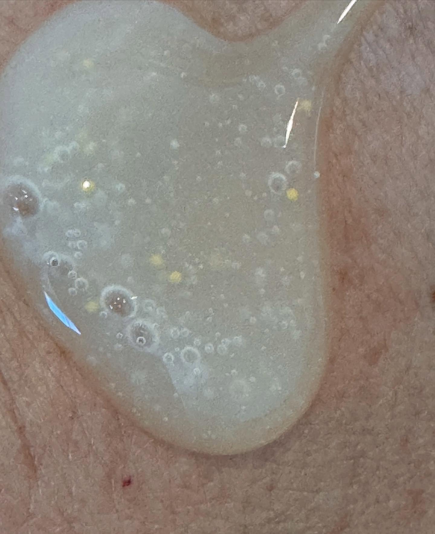 B3 アクネ クリア ボディウォッシュ/b.clinicx/ボディソープを使ったクチコミ（3枚目）