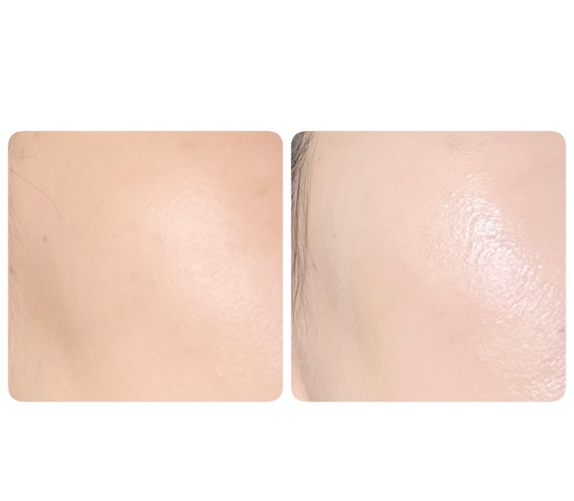 リードルS PDRN+ セラム/VT/美容液を使ったクチコミ（3枚目）