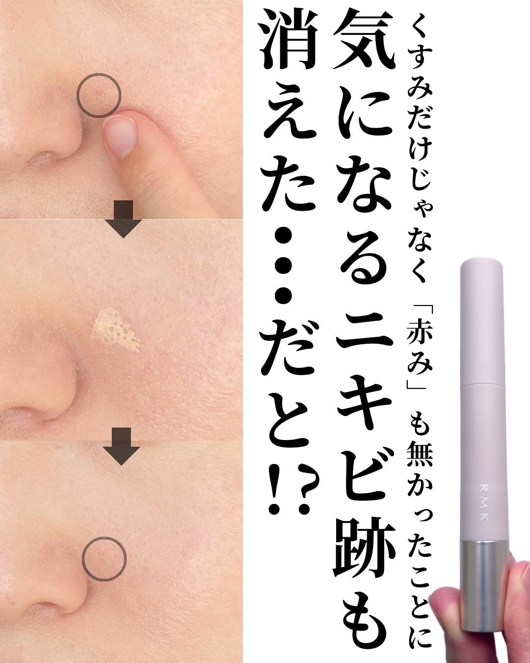 RMK コレクティング ヴェール コンシーラー/RMK/リキッドコンシーラーを使ったクチコミ(7枚目)