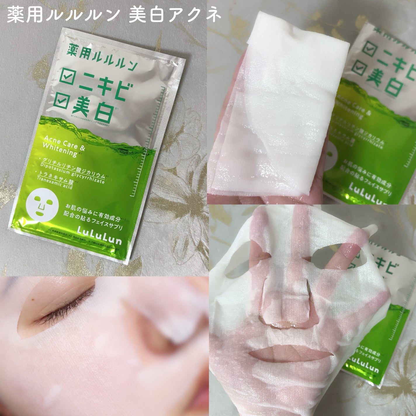 薬用ルルルン 美白アクネ/ルルルン/シートマスク・パックを使ったクチコミ(2枚目)