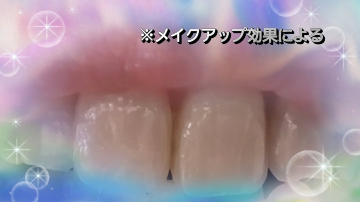 ハニックDC アクア/ハニック・ホワイトラボ/その他オーラルケアを使ったクチコミ（3枚目）