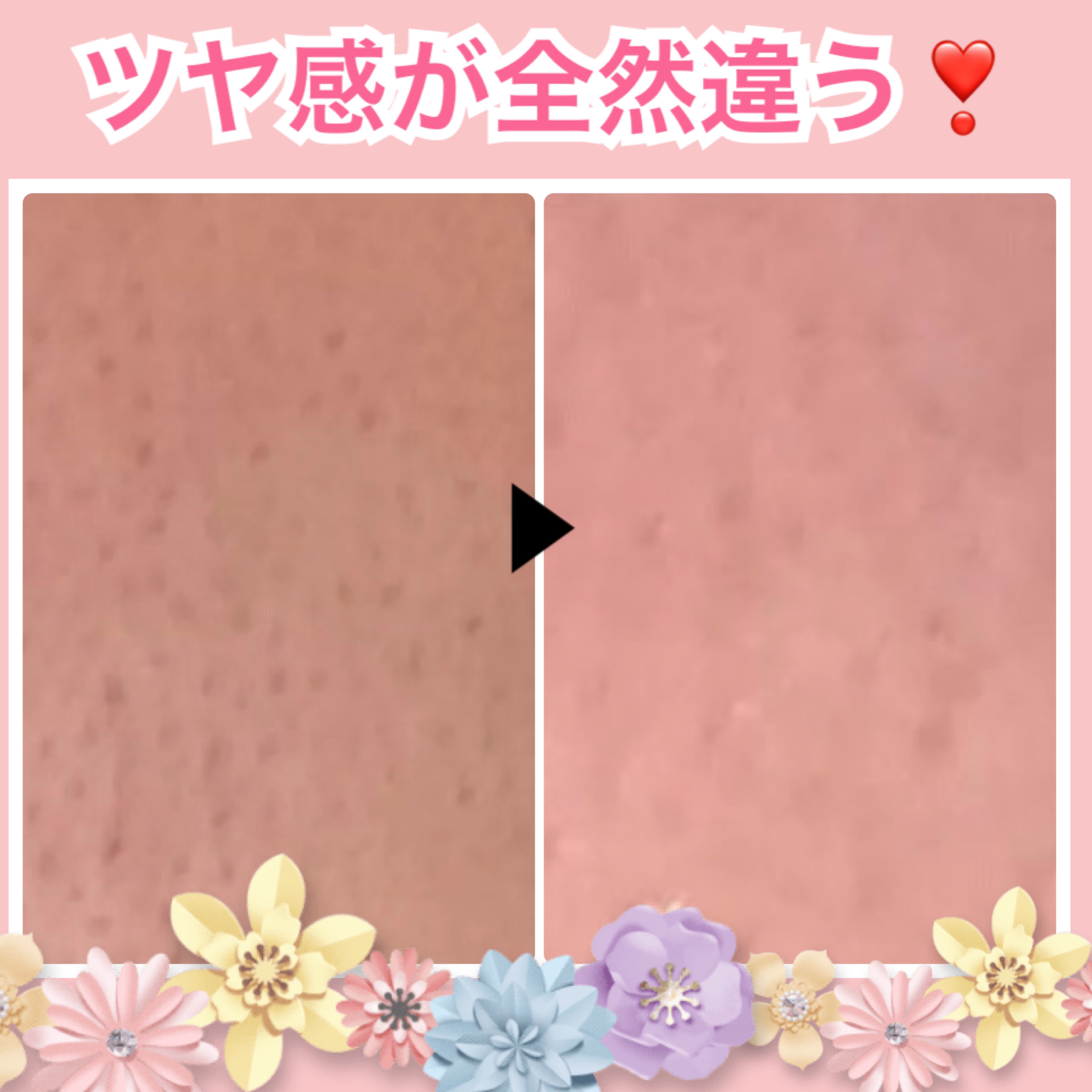 リードルS PDRN+ セラム/VT/美容液を使ったクチコミ（2枚目）