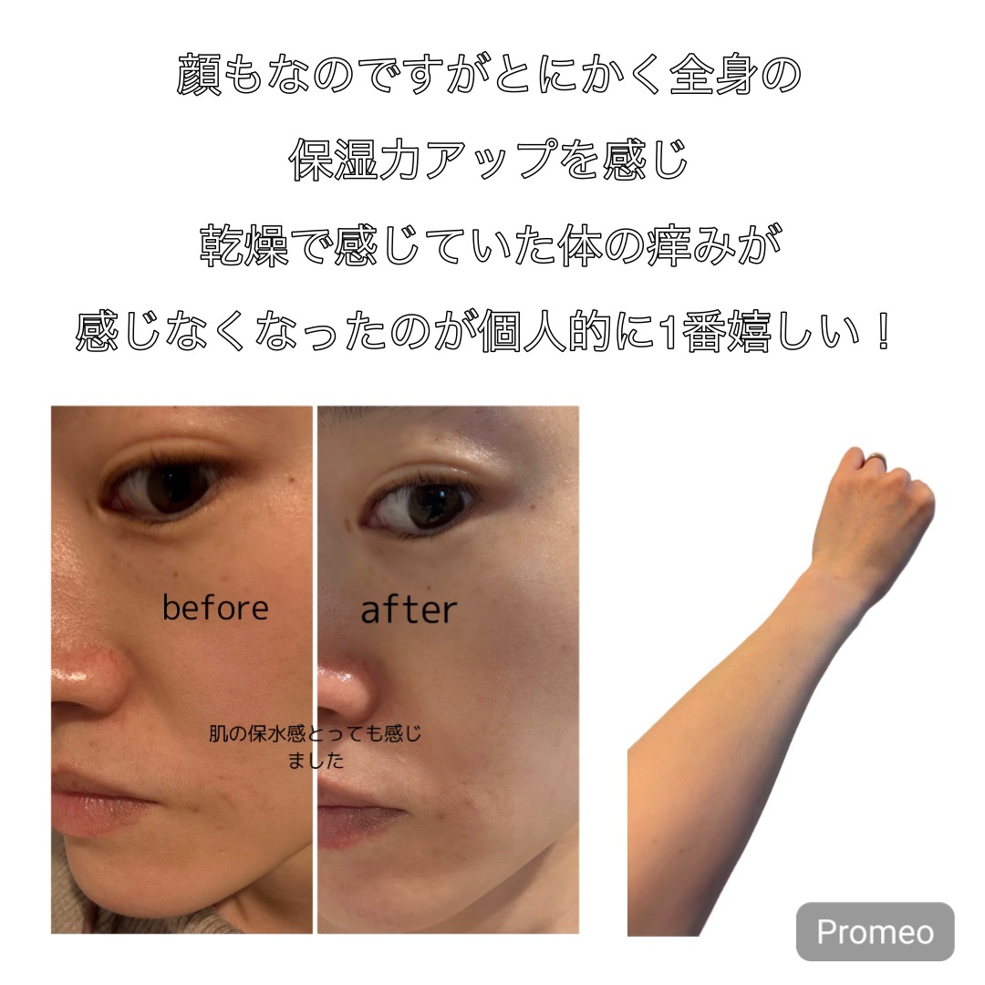 ILO ムチンコラーゲンゼリー/東亜製薬/美容サプリメントを使ったクチコミ（3枚目）