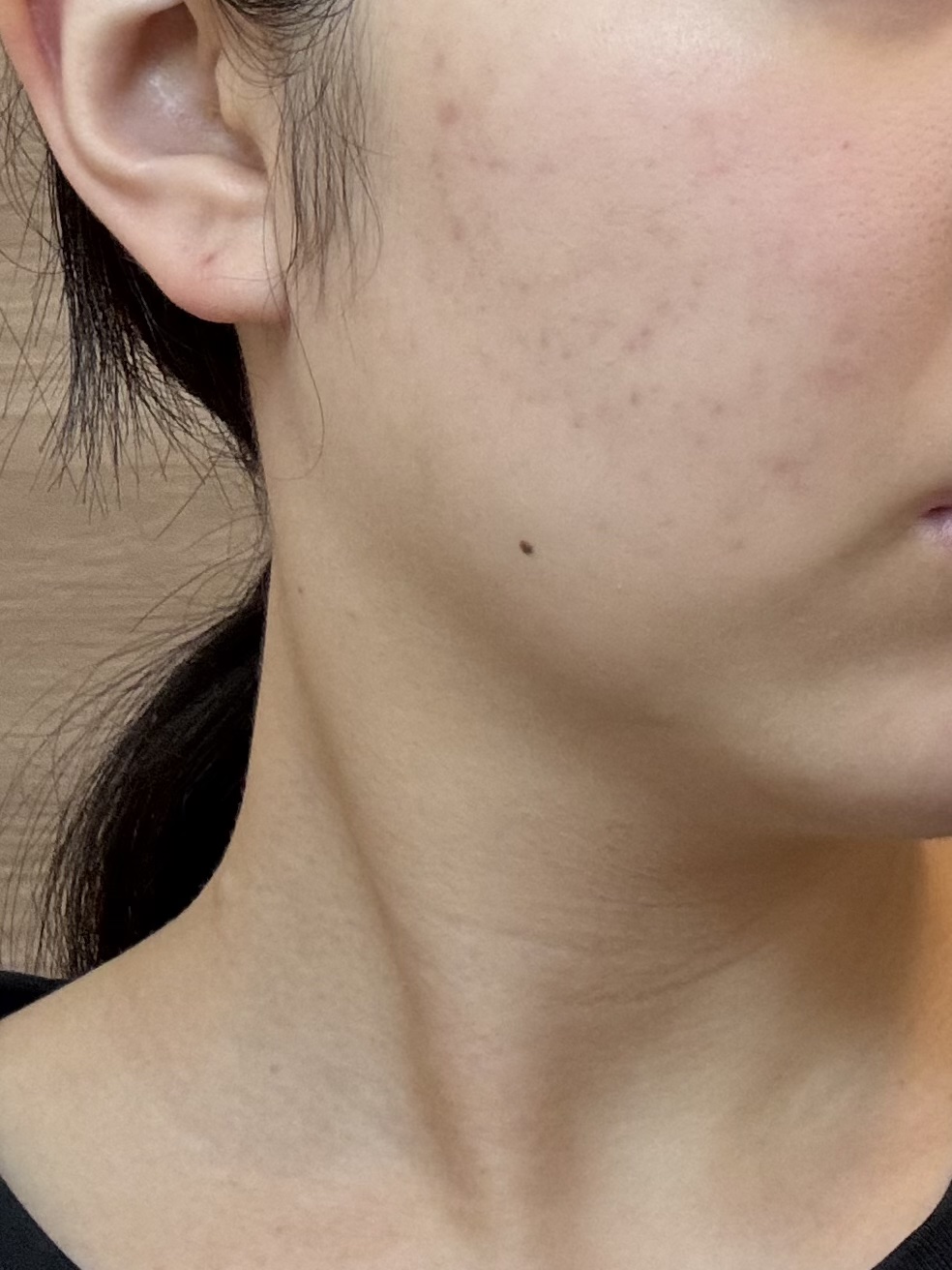 浸透湿潤セラミド１０％★ナノエマルジョン/TOUT VERT/乳液を使ったクチコミ（1枚目）