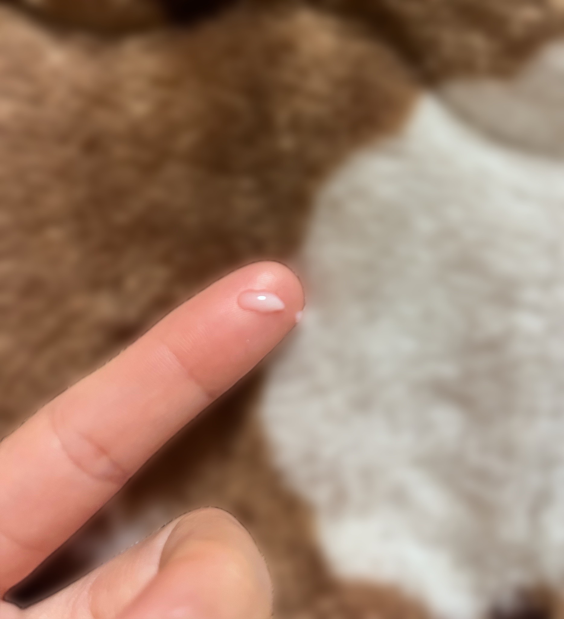 クリアフル アクネ ブライト エッセンス/オルビス/美容液を使ったクチコミ（2枚目）