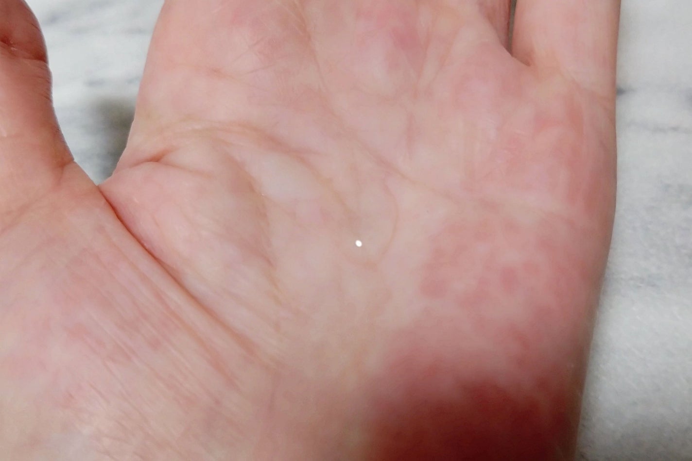 ガラク ナイアシン 3.0 エッセンス/manyo/美容液を使ったクチコミ(4枚目)