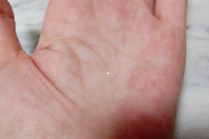 ガラク ナイアシン 3.0 エッセンス/manyo/美容液を使ったクチコミ(4枚目)