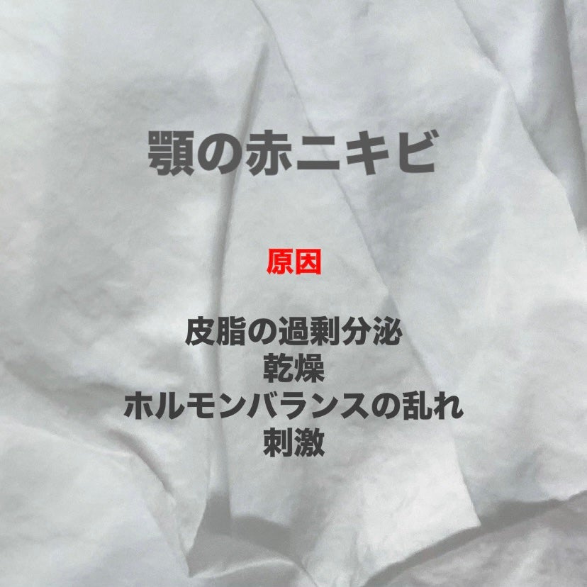 潤浸保湿 美容液/キュレル/美容液を使ったクチコミ(2枚目)