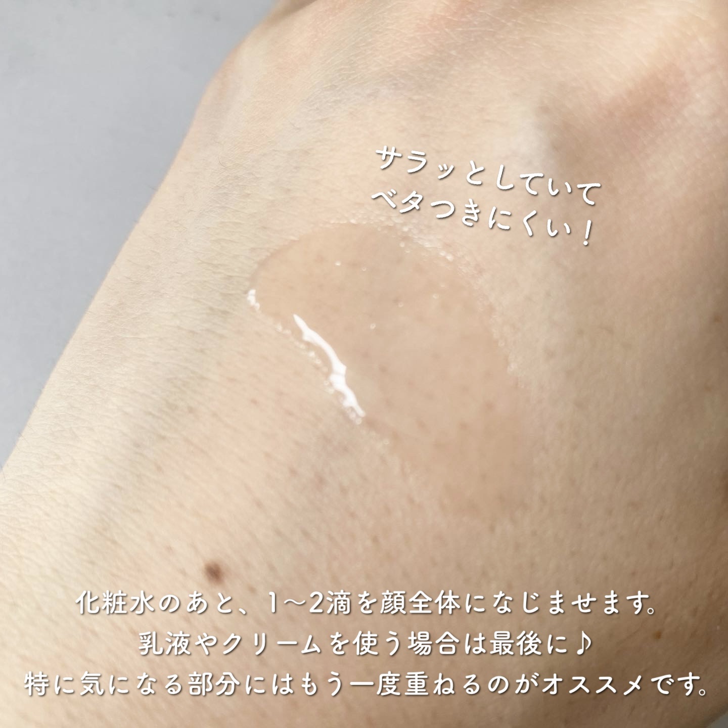 バイオイル/バイオイル/フェイスオイルを使ったクチコミ（2枚目）