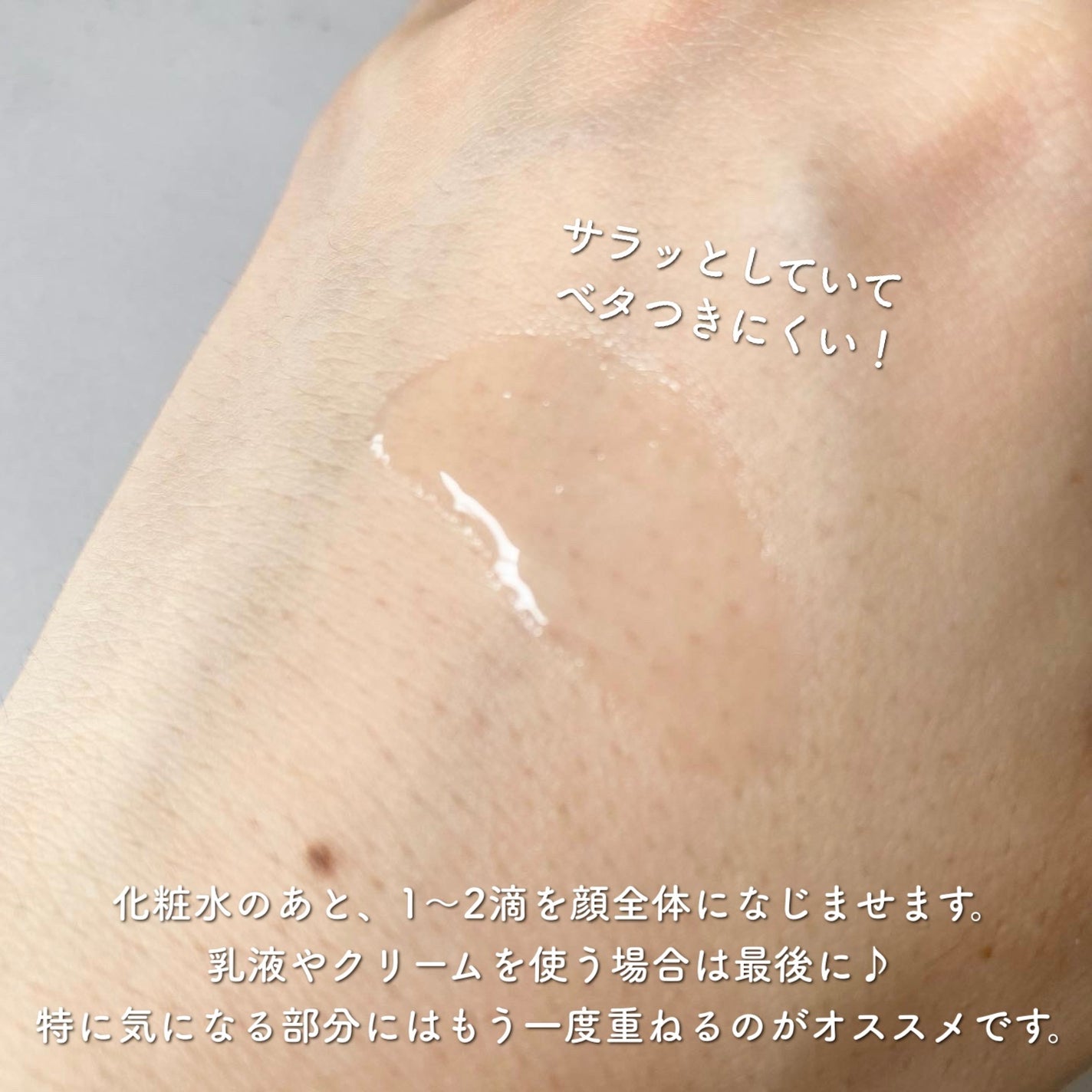 バイオイル/バイオイル/フェイスオイルを使ったクチコミ(2枚目)