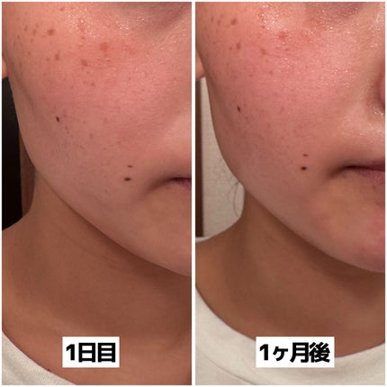 cleansing cream/Do white+/クレンジングクリームを使ったクチコミ(2枚目)