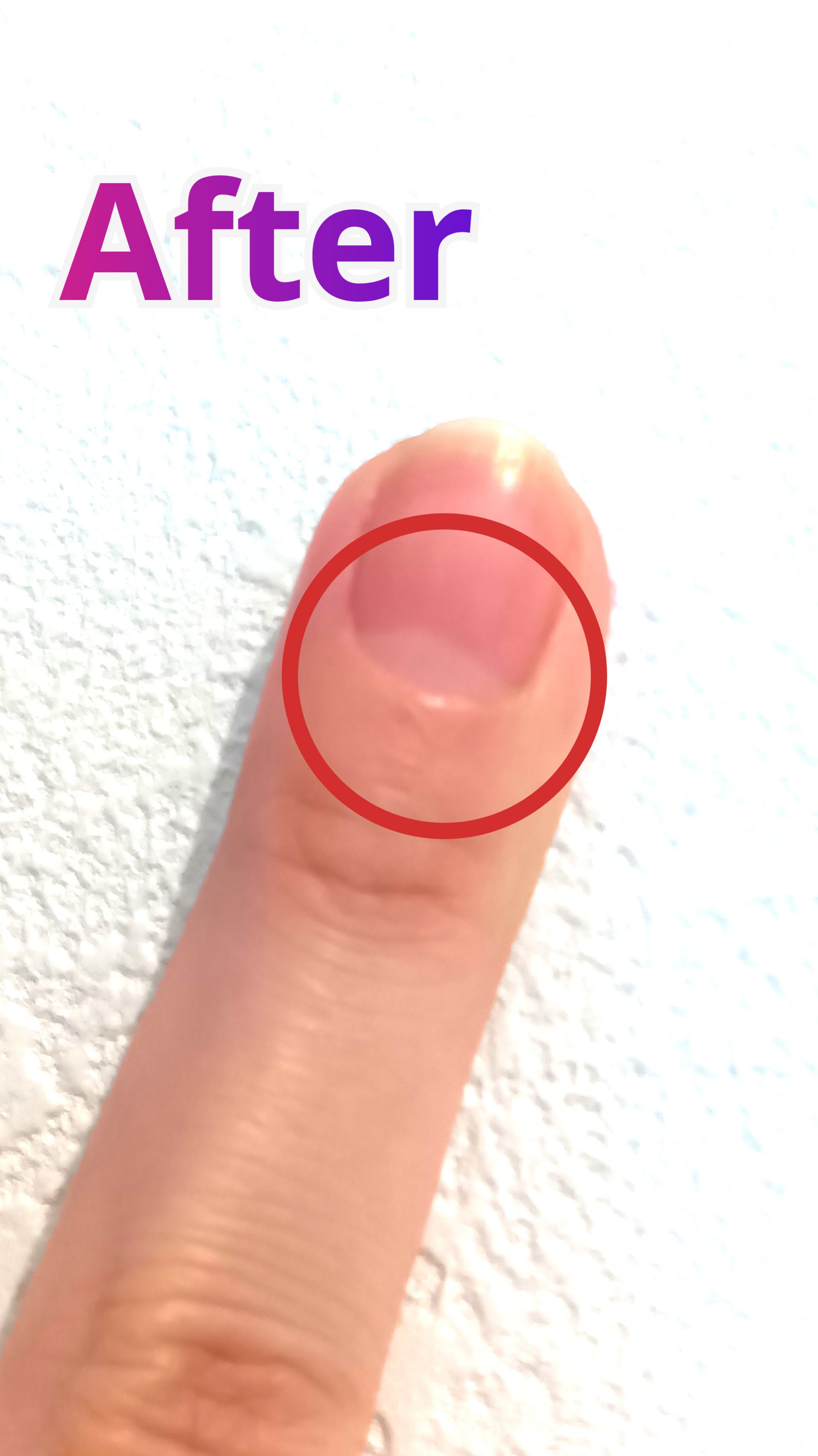 pa キューティクルリムーバー/pa nail collective/ネイルオイル・トリートメントを使ったクチコミ（3枚目）