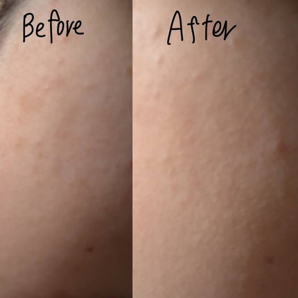 SPステイ ルミマット リキッド ファンデーション/MAYBELLINE NEW YORK/リキッドファンデーションを使ったクチコミ(4枚目)