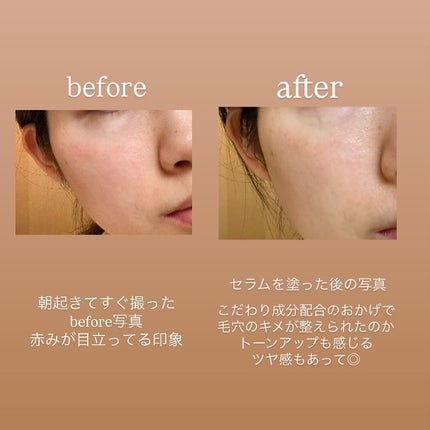 サミュ ガラクトポア セラム/SAM'U/美容液を使ったクチコミ(4枚目)