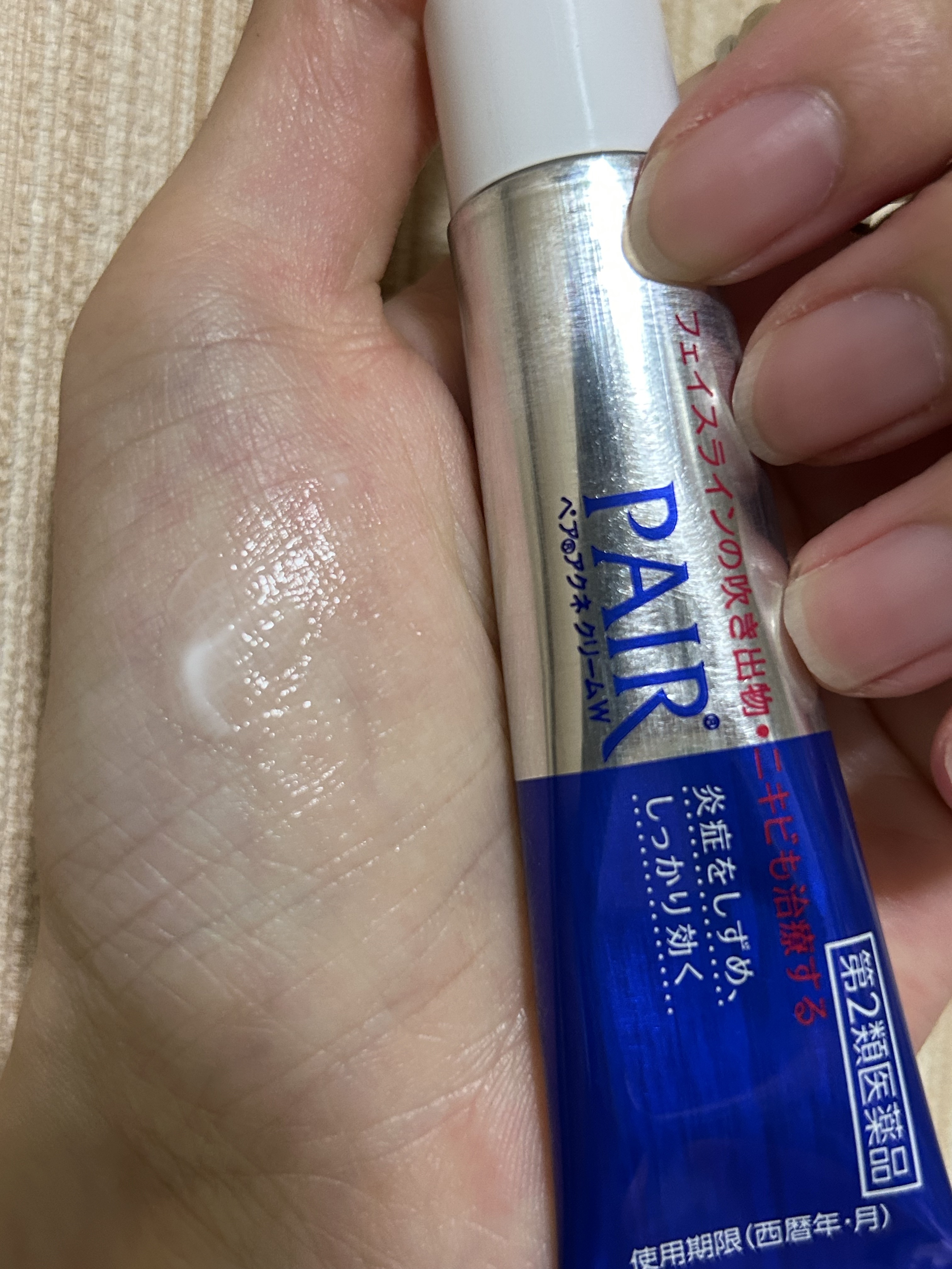 ペアアクネクリームW(医薬品)/ペア/その他を使ったクチコミ（2枚目）