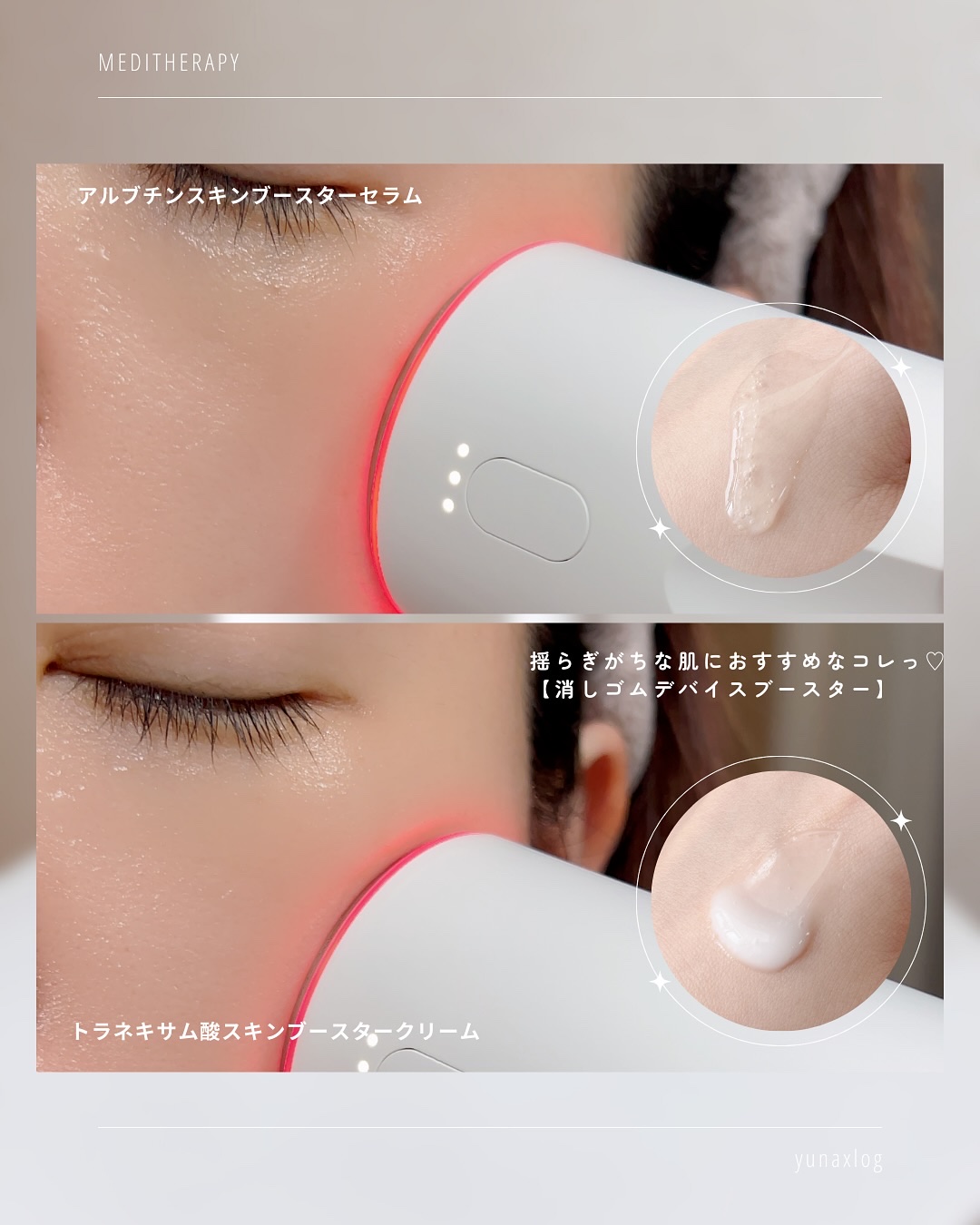 を使ったクチコミ（2枚目）