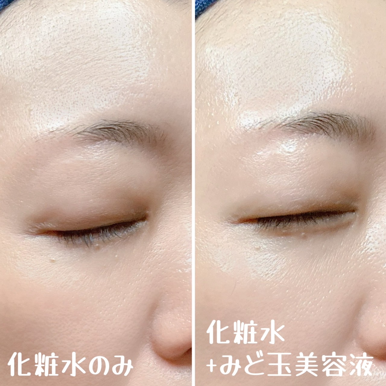 ベターツリカン肌荒れ美容液/Mildlab/美容液を使ったクチコミ（3枚目）