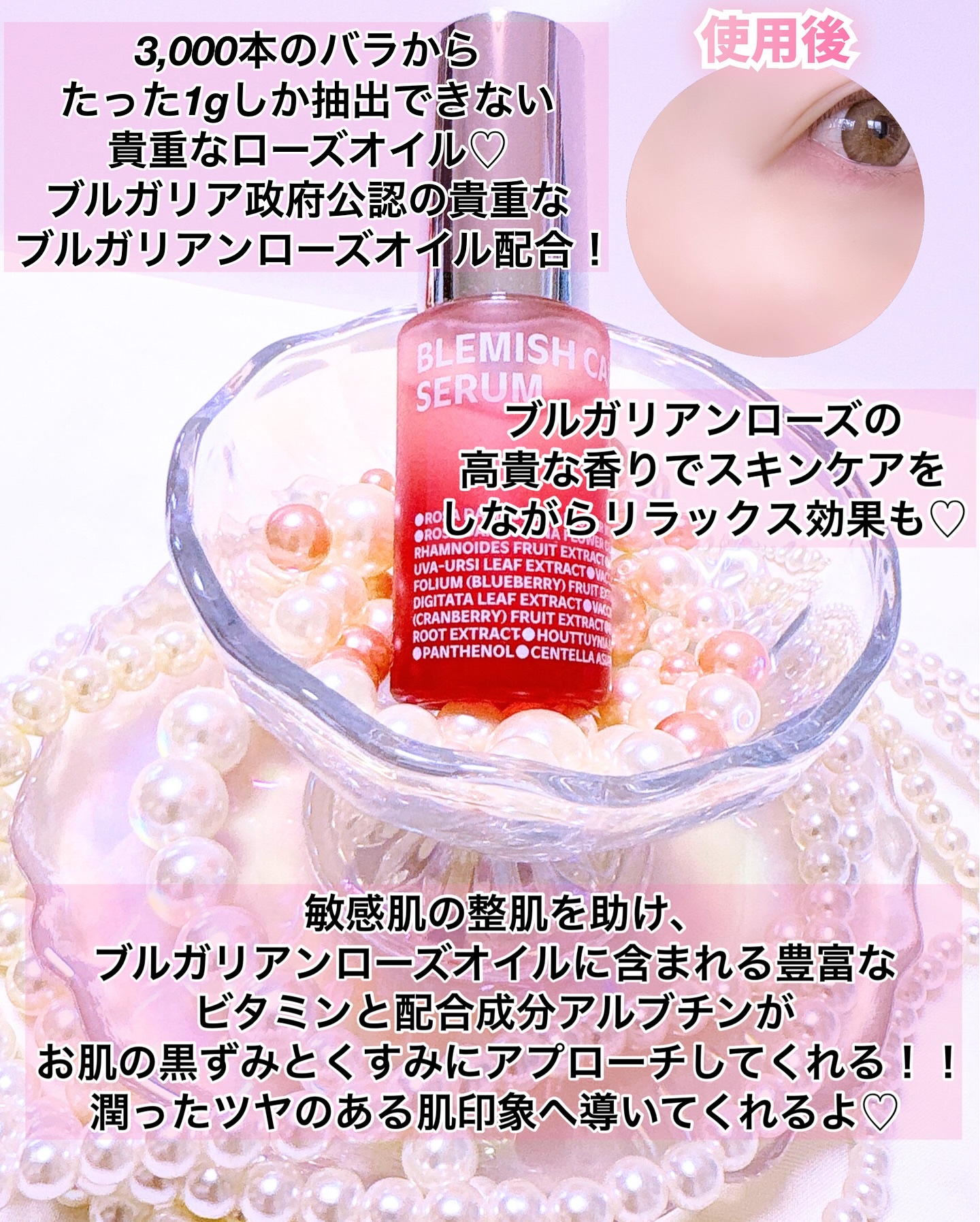 ブレミッシュケアアップ セラム/ISOI/美容液を使ったクチコミ（3枚目）