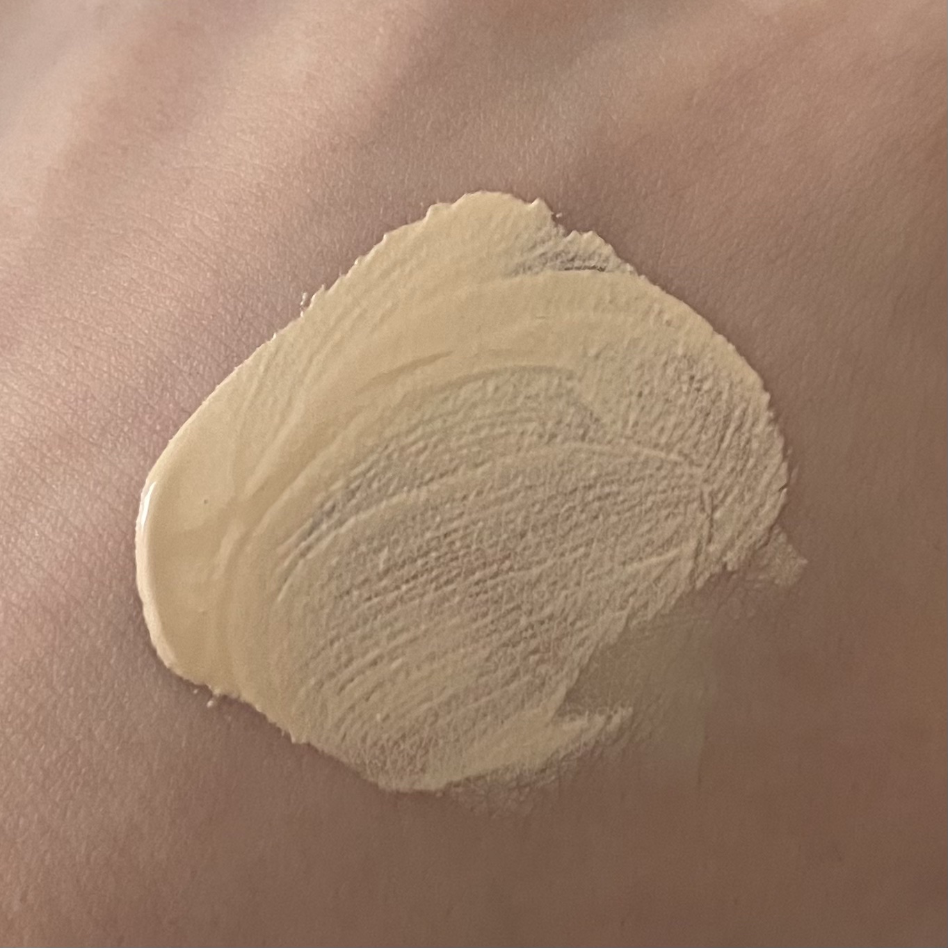 シカレチA エッセンス0.1/VT/美容液を使ったクチコミ（2枚目）