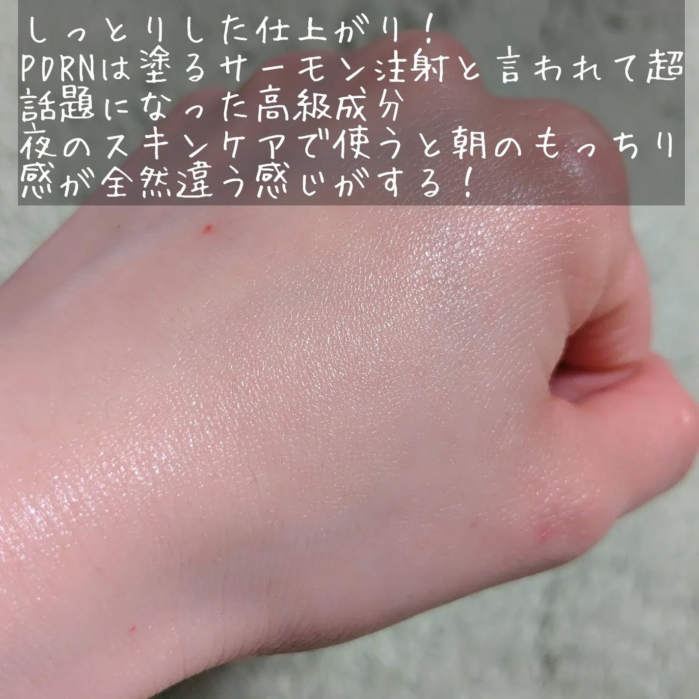 ダーマアンサー PDRN アクティブブースト1:1アンプル/CNP Laboratory/美容液を使ったクチコミ(4枚目)