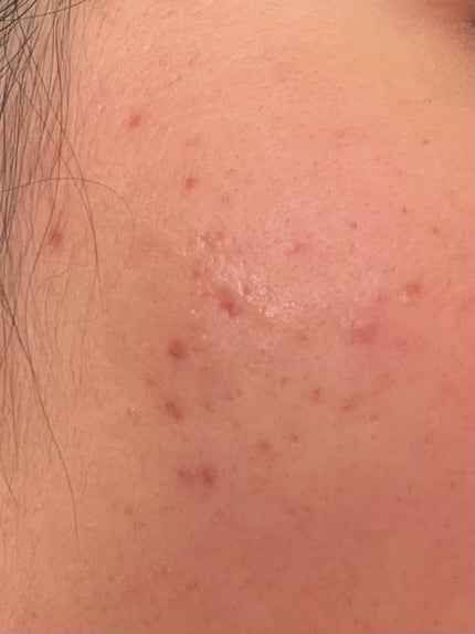 を使ったクチコミ(2枚目)