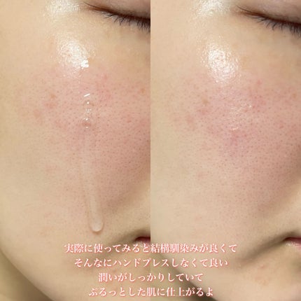 レッドブレミッシュ ヒアルシカスージングセラム/Dr.G/美容液を使ったクチコミ(5枚目)