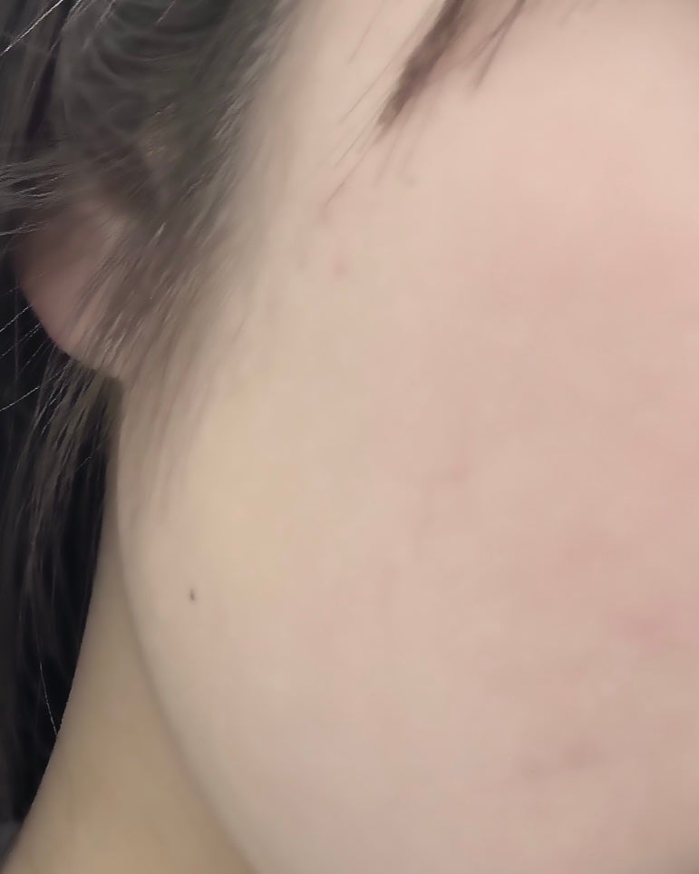 ãã©ã³ã¹ã«ãŒã»ã³ãã»ãããã£ããã·ã³ã°ããŠããŒ/TFIT/ã«ãŒã¹ããŠããŒã䜿ã£ãã¯ãã³ãïŒ1æç®ïŒ