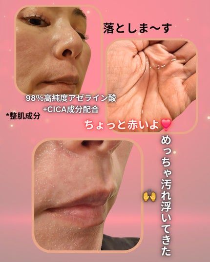 AZケア クレンジングオイル/VT/オイルクレンジングを使ったクチコミ(2枚目)