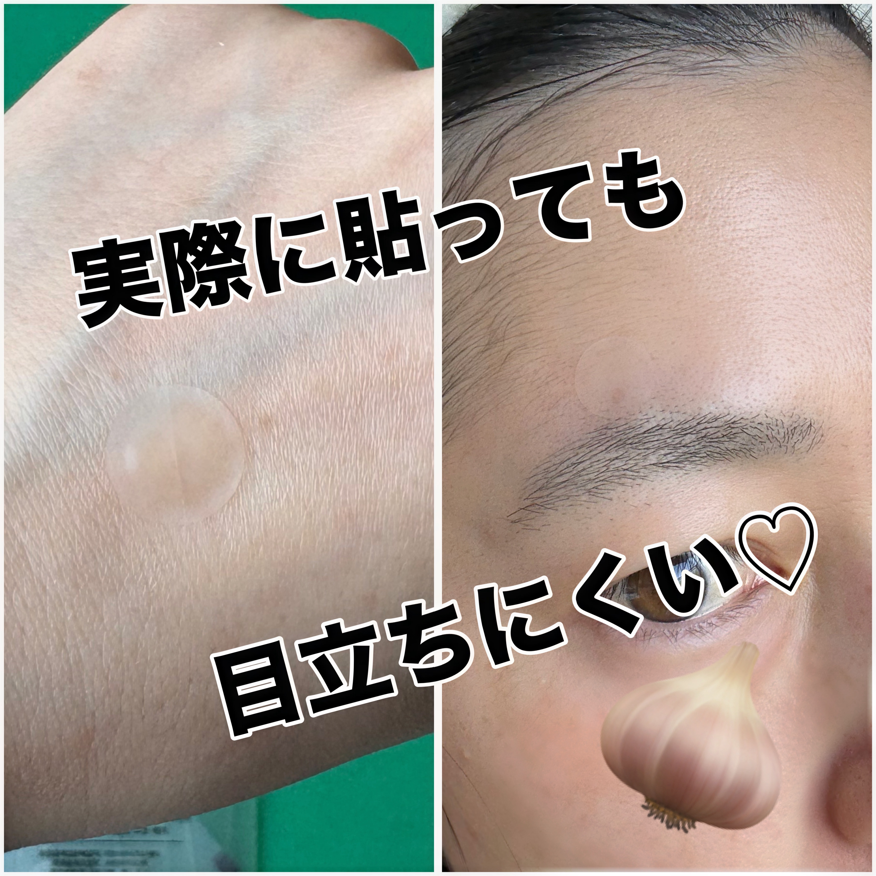 ガーリック リードルショット スポットパッチ/VT/その他スキンケアを使ったクチコミ（3枚目）