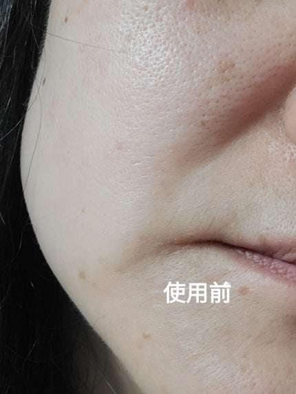 グルタチオンショットB3シミ跡セラム/It's skin/美容液を使ったクチコミ(4枚目)