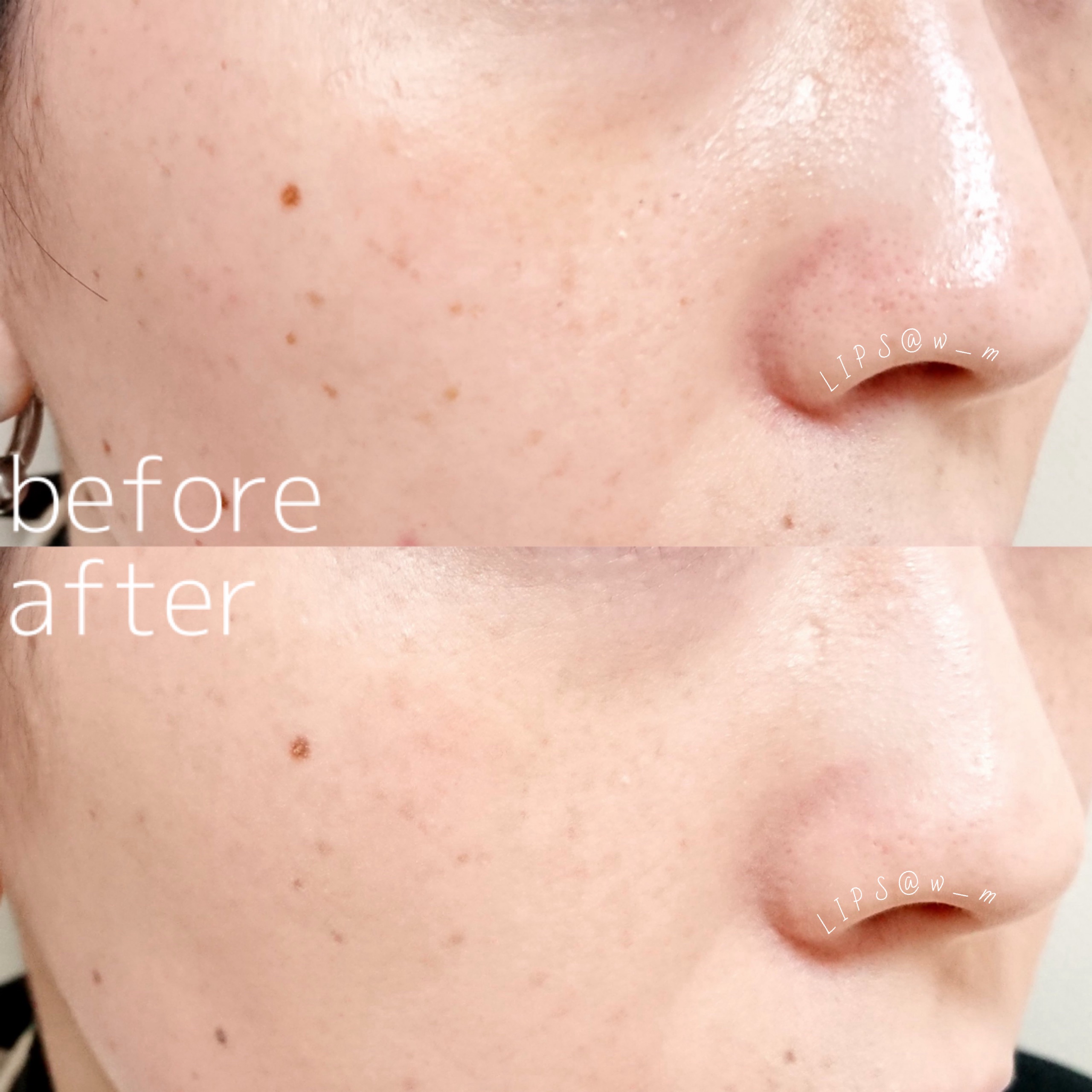 マットシフォン UVリキッドファンデ/KiSS/リキッドファンデーションを使ったクチコミ（2枚目）