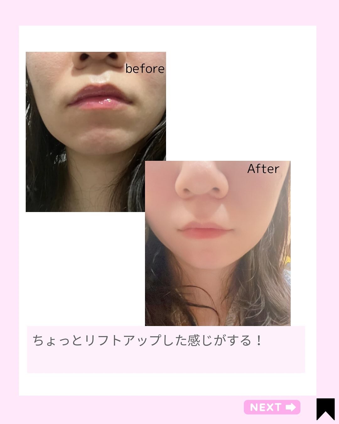 Kana on LIPS 「日々の疲れを感じる時は、耳へのやさしいケアで気分転換。そんな時..」(5枚目)