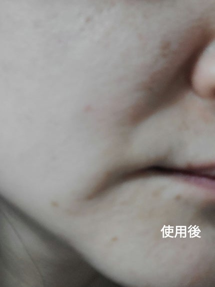 グルタチオンショットB3シミ跡セラム/It's skin/美容液を使ったクチコミ(5枚目)