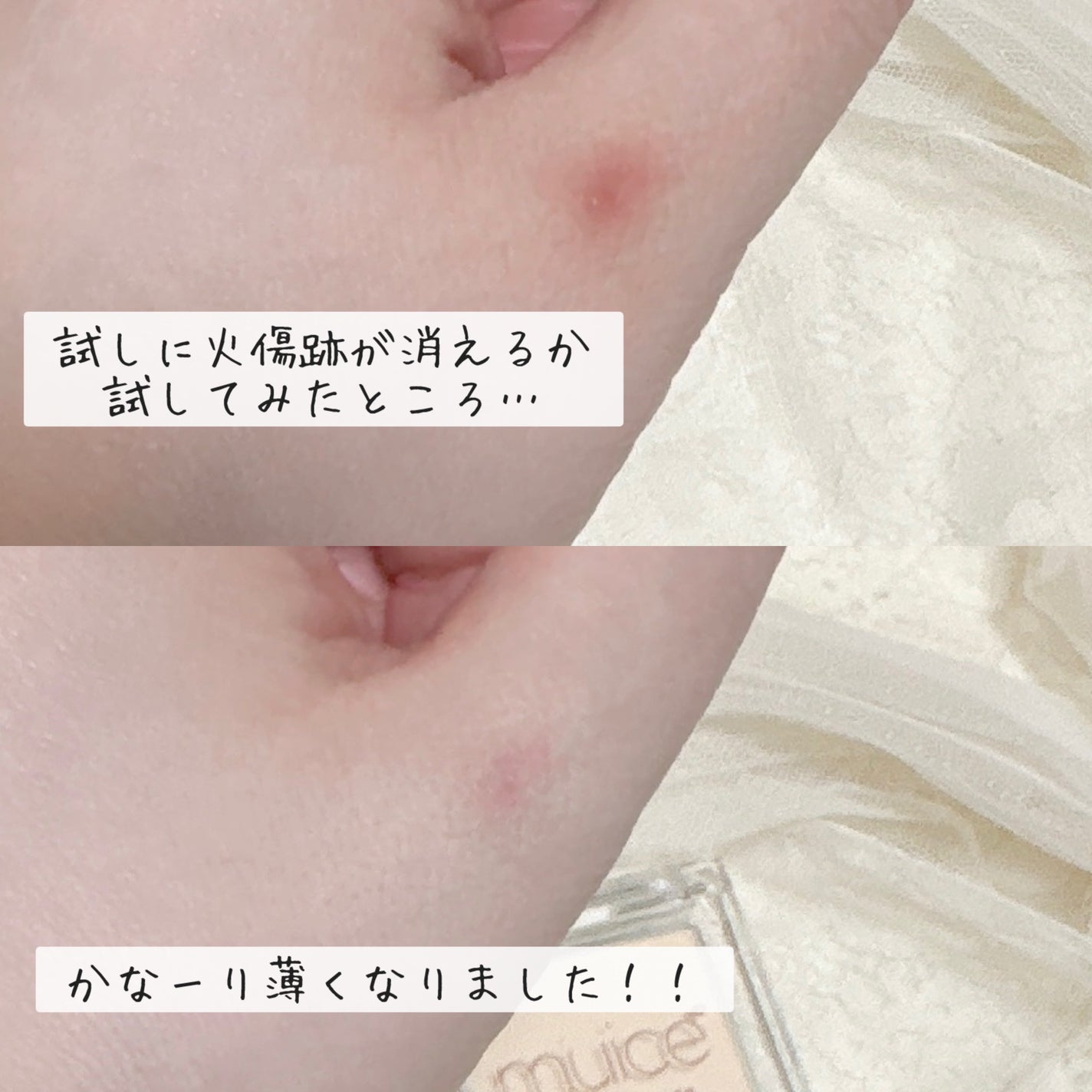 スポットメンテパウダー/muice/プレストパウダーを使ったクチコミ(4枚目)