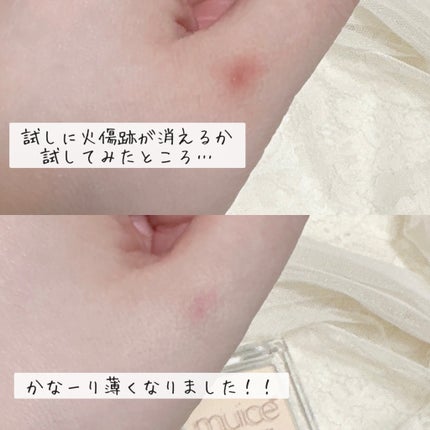 スポットメンテパウダー/muice/プレストパウダーを使ったクチコミ(4枚目)