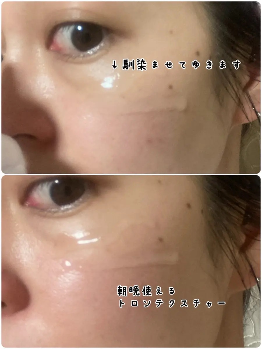 クローザーセラム/Frankly/美容液を使ったクチコミ（3枚目）