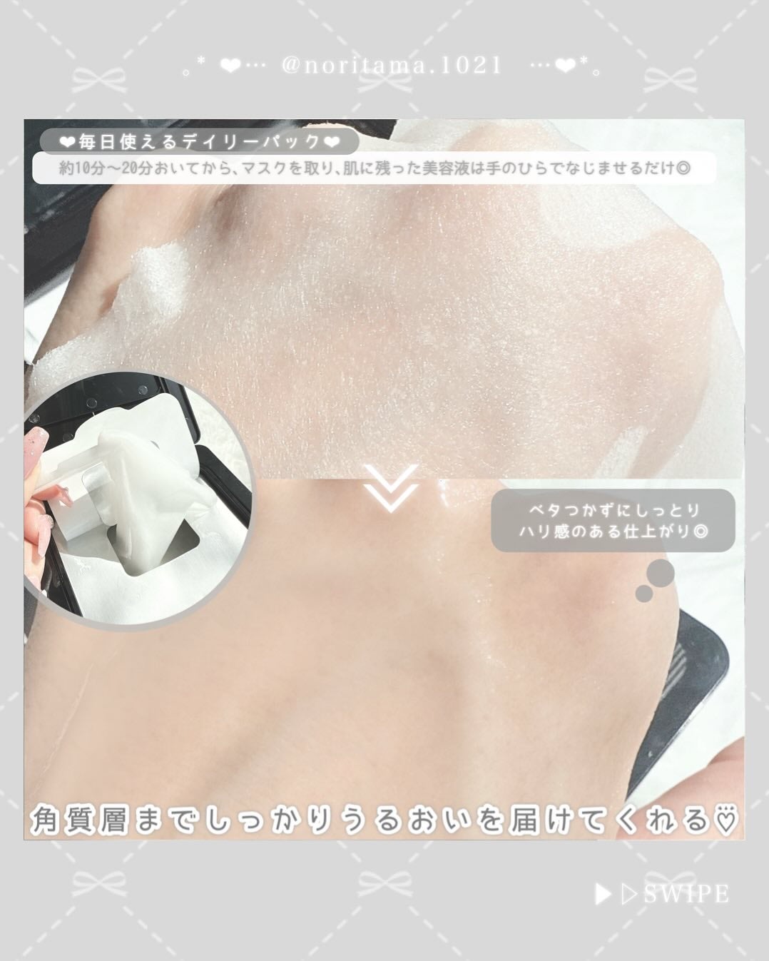 ブラックPDRN デイリーシートマスク/ネイチャーリパブリック/シートマスク・パックを使ったクチコミ(4枚目)