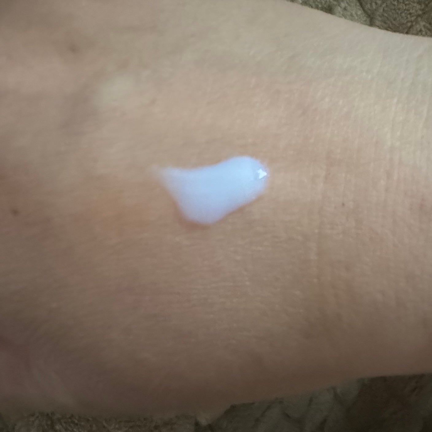 ã¡ãŸã³ ã ã«ãŒã ãã©ã€ããã³ã° ãã¹ãã»ã©ã /ããªã¹ã¢ãã/ããã£ããŒã·ã§ã³ã䜿ã£ãã¯ãã³ãïŒ3æç®ïŒ